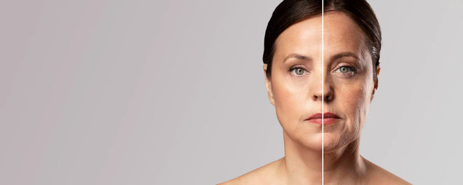 How to Support Skin Firmness After Ozempic or Wegovy