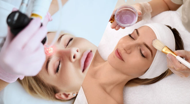 Chemical Peels vs Laser Treatments: Which Might Suit Your Skin Best?