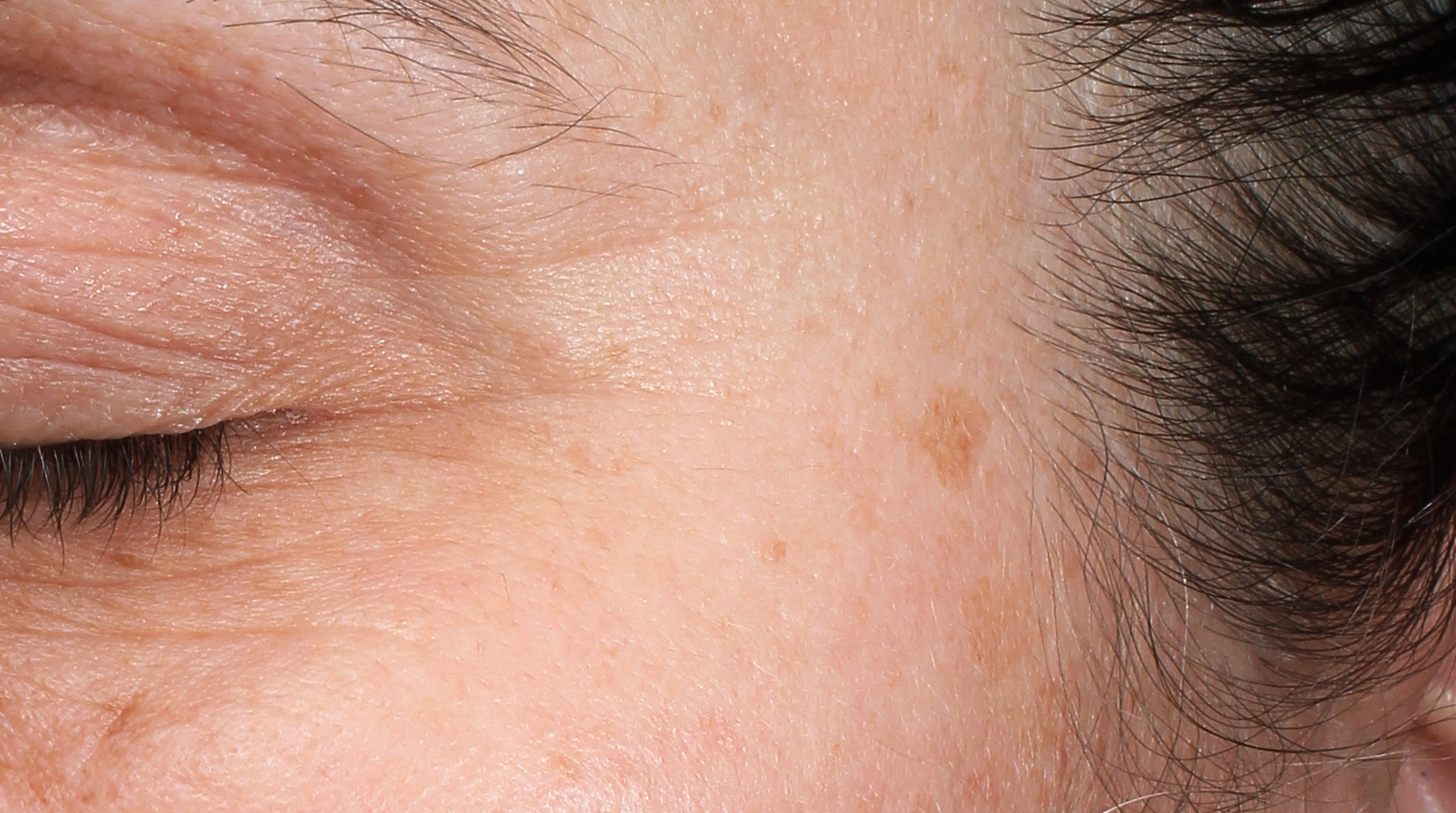 After using CELF Rejuvenation Station - CELF is proven to dramatically reduce wrinkles