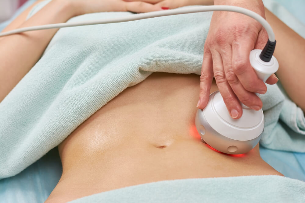 Radiofrequency vs. Ultrasound for Skin Tightening