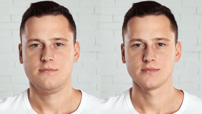 Facial Volume Loss: Why Faces Look Different Over Time