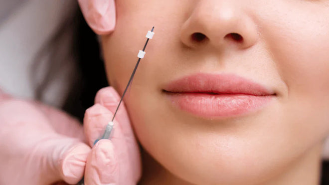 PDO Threads vs Fillers: Which is Better for Facial Rejuvenation?