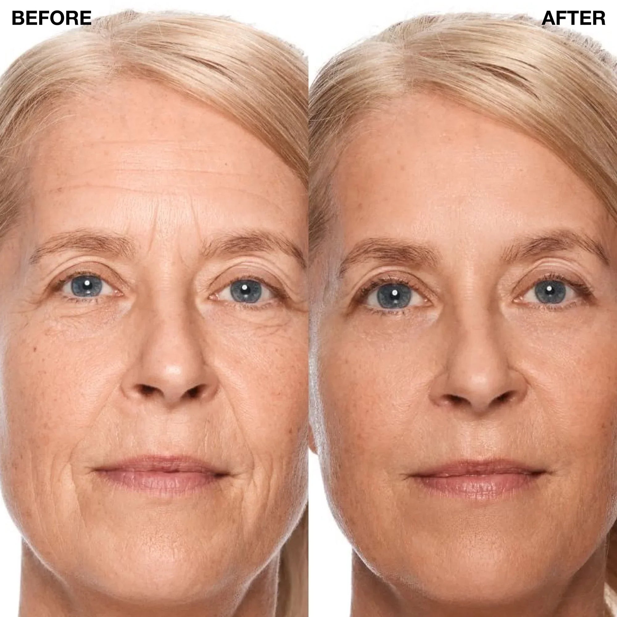 Sculpting Wands: Do They Work for Face Lifting?