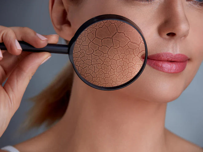 Skin Barrier Repair: What to Use & What to Avoid