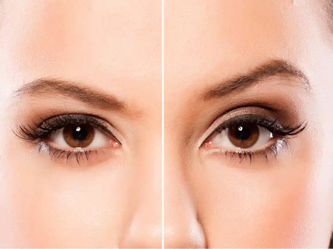 Non-Surgical Brow Lift Options Explained