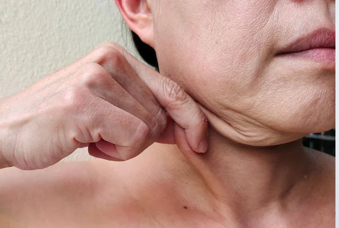 How to Tighten Facial Skin After Weight Loss Naturally