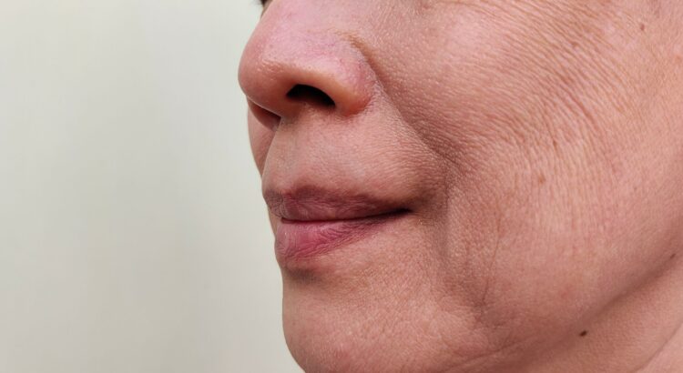 What Are the Best Smile Line Treatment Options and How Do They Compare in 2026?