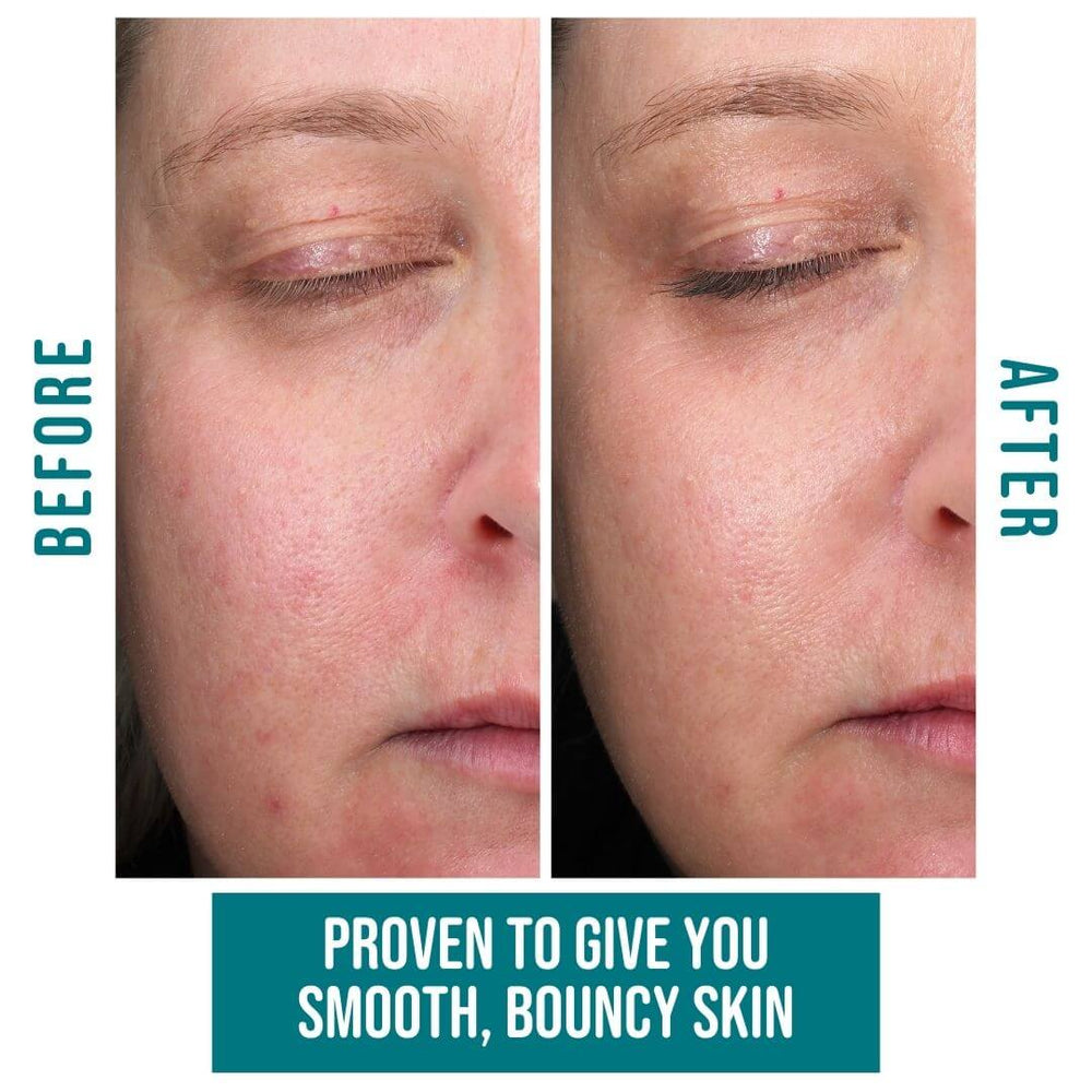 CELF best skin care products Collagen benefits before and after results SKINCARE Image