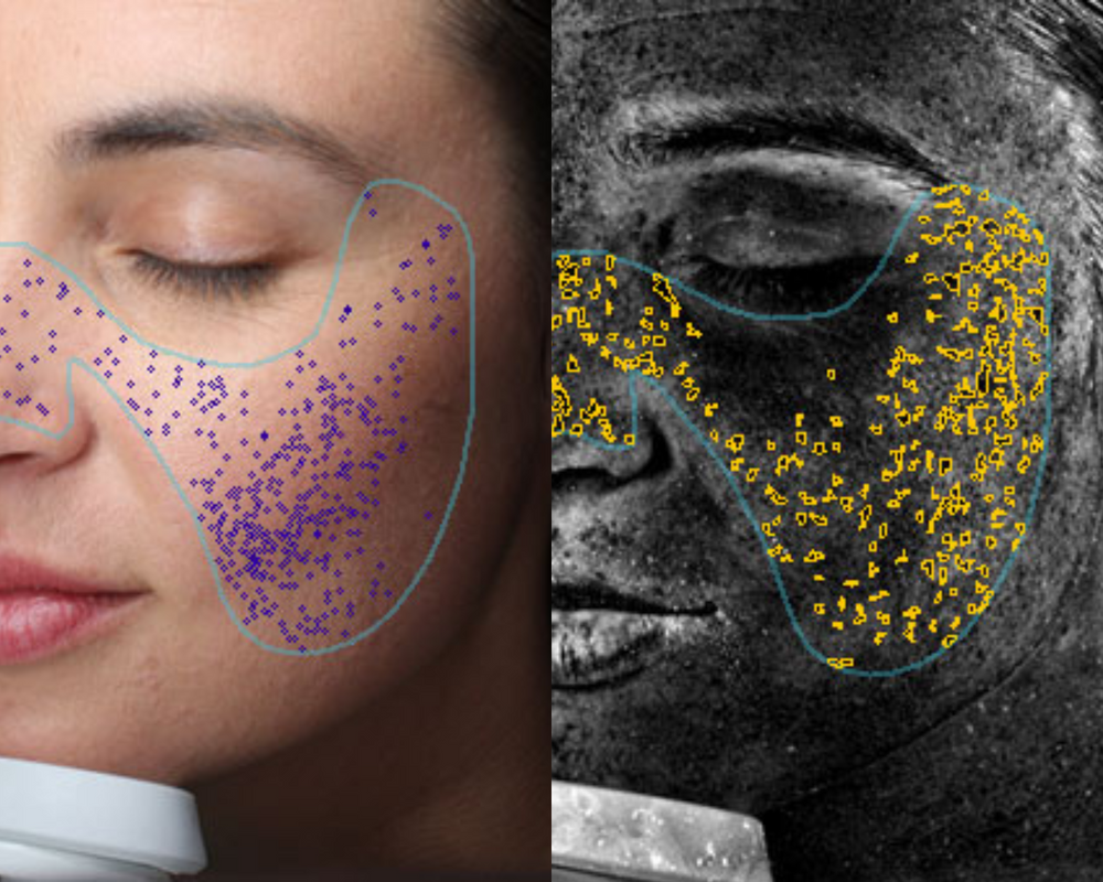 Increase skin luminosity - Photo showing age spots - CELF Beauty
