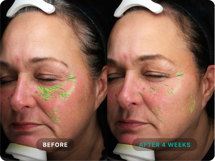 Independent Clinical Results