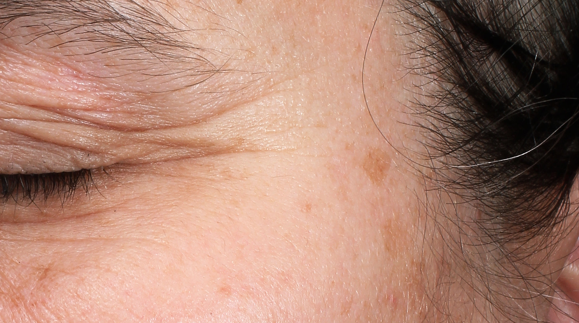 Before using CELF Rejuvenation Station - CELF is proven to dramatically reduce wrinkles
