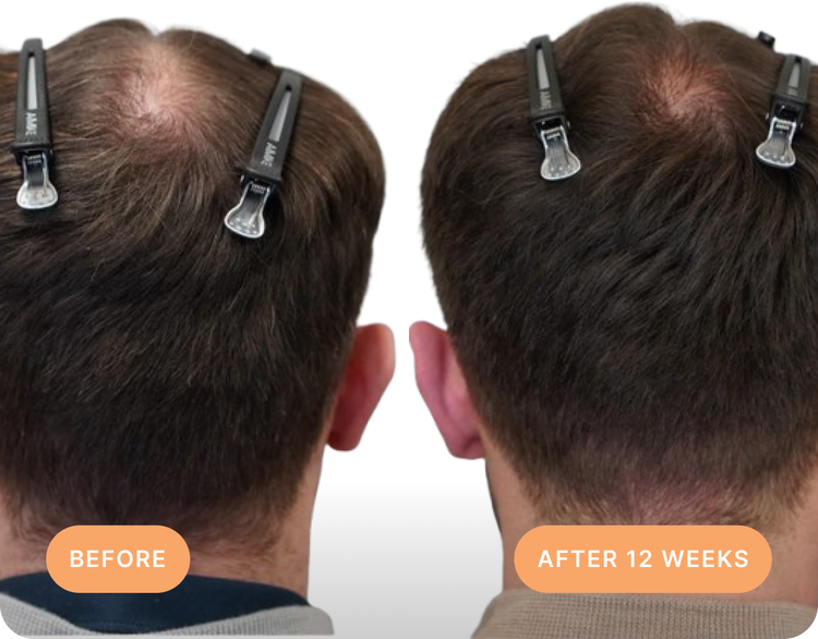 Independent Clinical Results